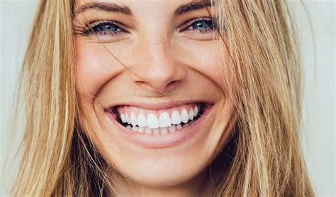invisalign valbonne|Cyrille Gassot .